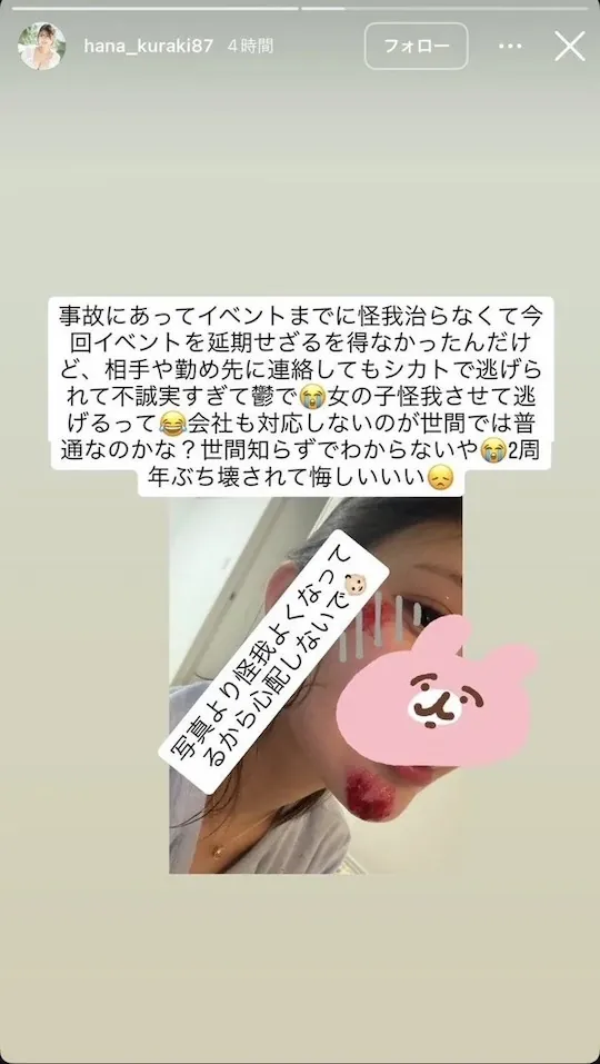 HANA KURAKI RIP 寫真